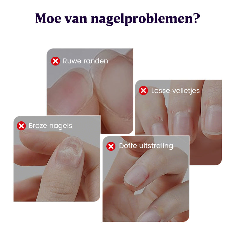 💜2026 Nieuwe verbeterde 3-in-1 nagelverzorgingspen