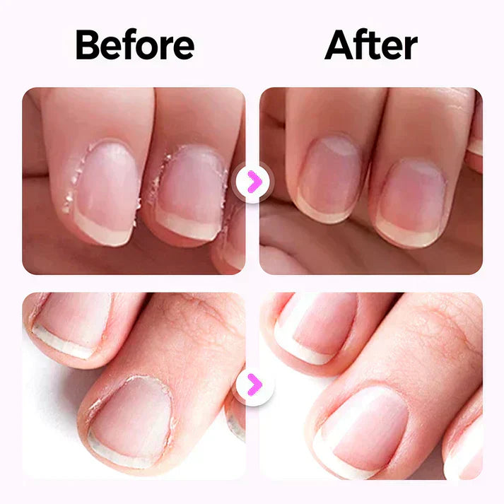 🔥Solange der Vorrat reicht 50 % Rabatt!🎉Universelle automatische Nagelfeile für Erwachsene und Kinder